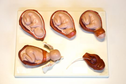 Anatomisch model geboorte stadia